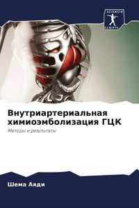Produktbild: Vnutriarterial'naq himio&auml;mbolizaciq GCK