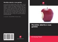 Produktbild: Mordida aberta e sua gest&atilde;o