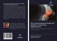 Produktbild: Een morfometrische studie van Patella in Total Knee Replacement
