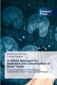Produktbild: A Hybrid Approach for Detection and Classification of Brain Tumor