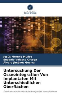 Produktbild: Untersuchung Der Osseointegration Von Implantaten Mit Unterschiedlichen Oberfl&auml;chen