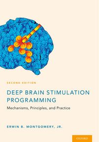 Produktbild: Deep Brain Stimulation Programming