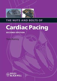 Produktbild: The Nuts and Bolts of Cardiac Pacing