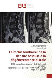 Produktbild: Le rachis lombaire: de la densit&eacute; osseuse &agrave; la d&eacute;g&eacute;n&eacute;rescence discale