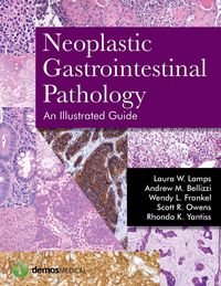 Produktbild: Neoplastic Gastrointestinal Pa