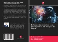 Produktbild: Detec&ccedil;&atilde;o de c&acirc;ncer de osso, pele e pulm&atilde;o em imagens de raio-x