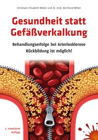 Produktbild: Gesundheit statt Gef&auml;&szlig;verkalkung