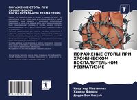 Produktbild: PORAZhENIE STOPY PRI HRONIChESKOM VOSPALITEL'NOM REVMATIZME