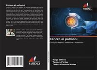 Produktbild: Cancro ai polmoni
