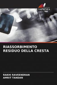 Produktbild: Riassorbimento Residuo Della Cresta