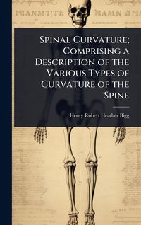 Produktbild: Spinal Curvature; Comprising a Description of the Various Types of Curvature of the Spine