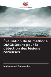 Produktbild: &Eacute;valuation de la m&eacute;thode DIAGNOdent pour la d&eacute;tection des l&eacute;sions carieuses