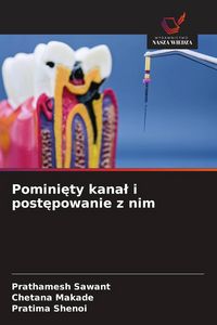 Produktbild: Pomini&iquest;ty kana&iquest; i post&iquest;powanie z nim