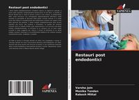 Produktbild: Restauri post endodontici