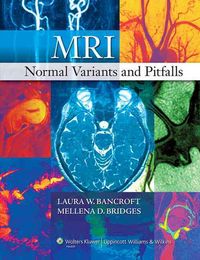 Produktbild: Mri Normal Variants & Pitfalls