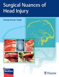 Produktbild: Surgical Nuances of Head Injury