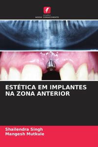 Produktbild: Est&eacute;tica Em Implantes Na Zona Anterior