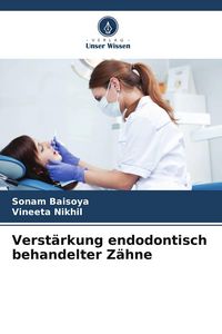 Produktbild: Verst&auml;rkung endodontisch behandelter Z&auml;hne