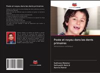 Produktbild: Poste et noyau dans les dents primaires