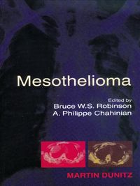 Produktbild: Mesothelioma