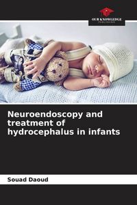 Produktbild: Neuroendoscopy and treatment of hydrocephalus in infants
