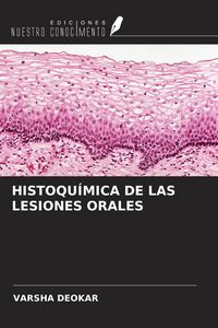 Produktbild: Histoqu&iacute;mica De Las Lesiones Orales