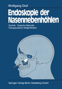 Produktbild: Endoskopie der Nasennebenh&ouml;hlen