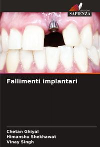 Produktbild: Fallimenti implantari