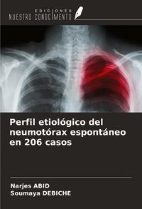 Produktbild: Perfil etiol&oacute;gico del neumot&oacute;rax espont&aacute;neo en 206 casos