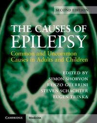 Produktbild: Causes of Epilepsy
