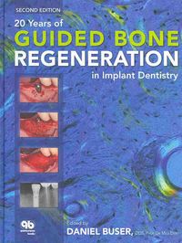 Produktbild: 20 Years Of Guided Bone Reg-2e