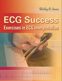 Produktbild: Jones, S: ECG Success! Exercises in ECG Interpretation