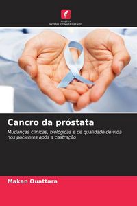 Produktbild: Cancro da pr&oacute;stata