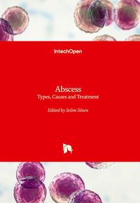 Produktbild: Abscess - Types, Causes and Treatment