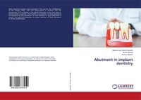 Produktbild: Abutment in implant dentistry