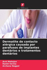 Produktbild: Dermatite de contacto al&eacute;rgica causada por parafusos de implantes dent&aacute;rios e tratamentos dent&aacute;rios