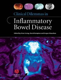 Produktbild: Clinical Dilemmas in Inflammatory Bowel Disease