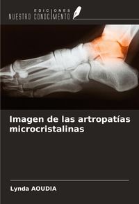 Produktbild: Imagen de las artropat&iacute;as microcristalinas