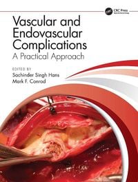 Produktbild: Vascular and Endovascular Complications: A Practical Approach