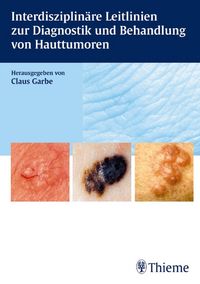 Produktbild: Interdisziplin&auml;re Leitlinien zur Diagnostik und Behandlung von Hauttumoren