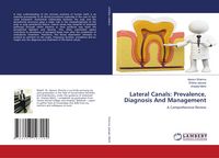 Produktbild: Lateral Canals: Prevalence, Diagnosis And Management