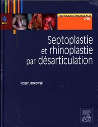 Produktbild: Septoplastie et rhinoplastie par d&eacute;sarticulation