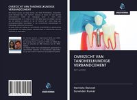 Produktbild: Overzicht Van Tandheelkundige Verbandcement