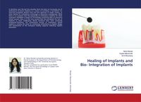 Produktbild: Healing of Implants and Bio- Integration of Implants