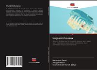 Produktbild: Implants basaux