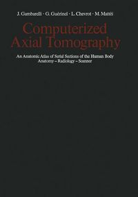 Produktbild: Computerized Axial Tomography