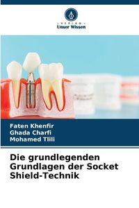 Produktbild: Die grundlegenden Grundlagen der Socket Shield-Technik