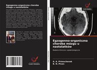 Produktbild: Egzogenno-organiczna choroba m&oacute;zgu u nastolatk&oacute;w