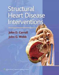 Produktbild: Structural Heart Disease Interventions