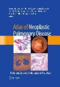 Produktbild: Atlas of Neoplastic Pulmonary Disease
